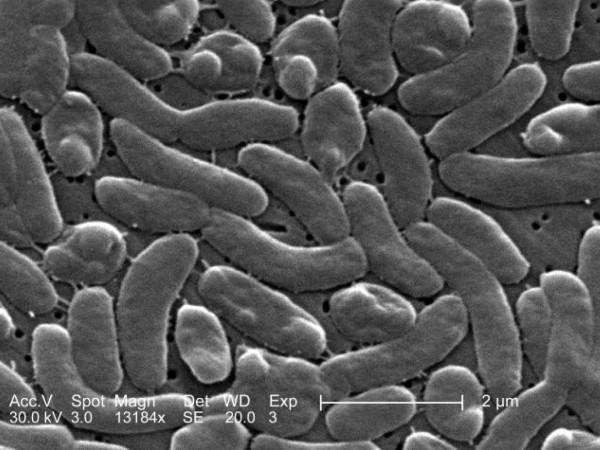 Alerta na Flórida: quatro mortes por bactéria "devoradora de carne" em 2025